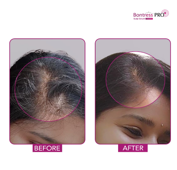 Bontress PRO+ Scalp Serum | 30ml